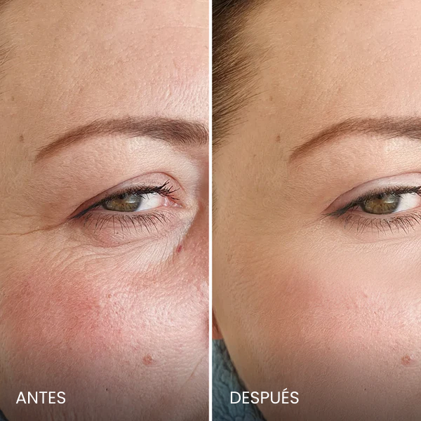 Avant / Après de Nathalie D.