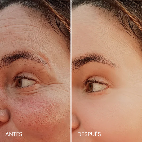 Avant / Après de Noémie R.
