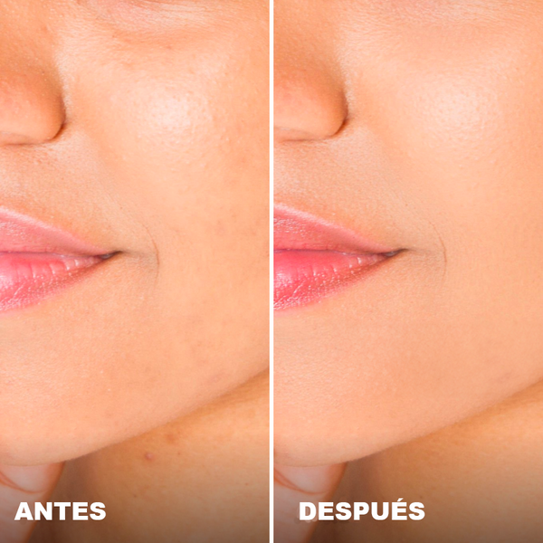 Avant / Après de Patricia R.