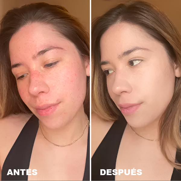 Avant / Après de Ariana H.