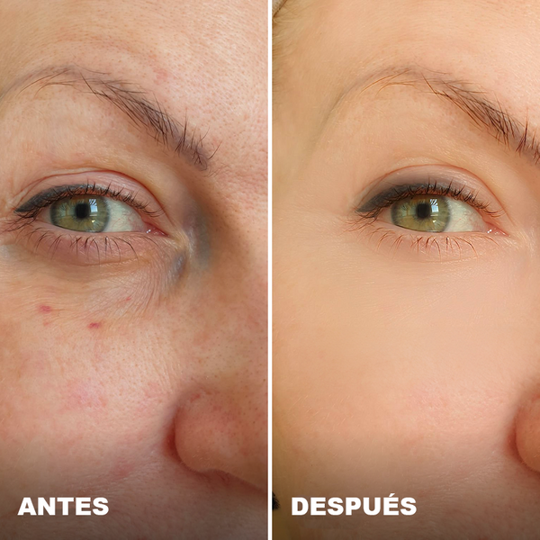 Avant / Après de Nadia F.