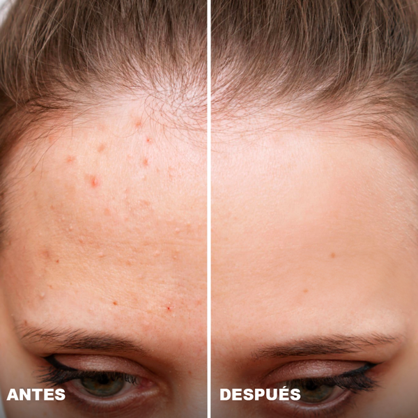 Avant / Après de Margarita C.