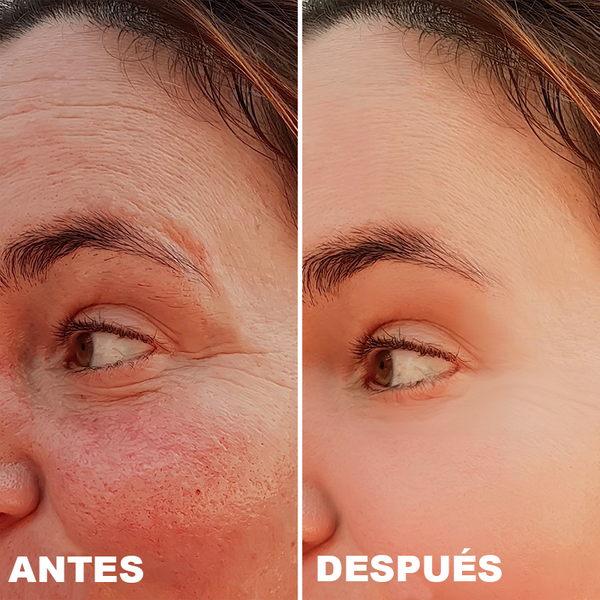 Avant / Après de Silvia R.